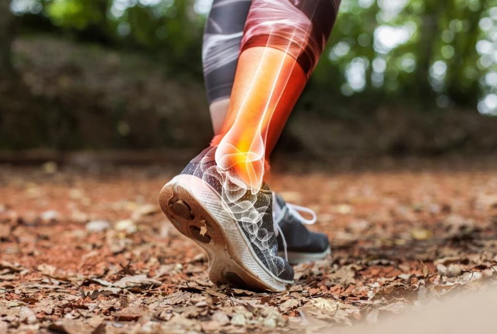 Handling Acute Sports Injuries: A Comprehensive Guide for&nbsp;Athletes